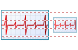 Cardiogram icons